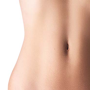 abdominoplastia renovarte cirugia plastica-3